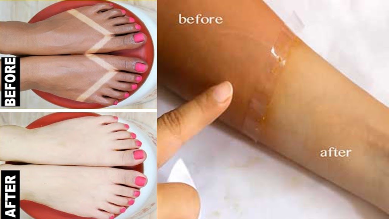 1 day skin whitening magical remedy 100 works get rid off sun tan instantly naturalhomeremedies