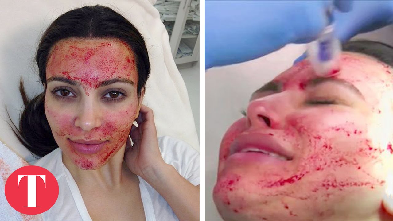 10 most shocking beauty treatments