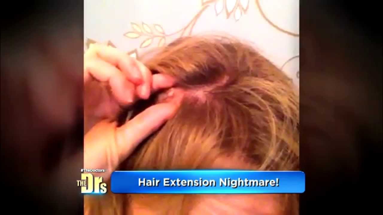 beauty procedures gone wrong
