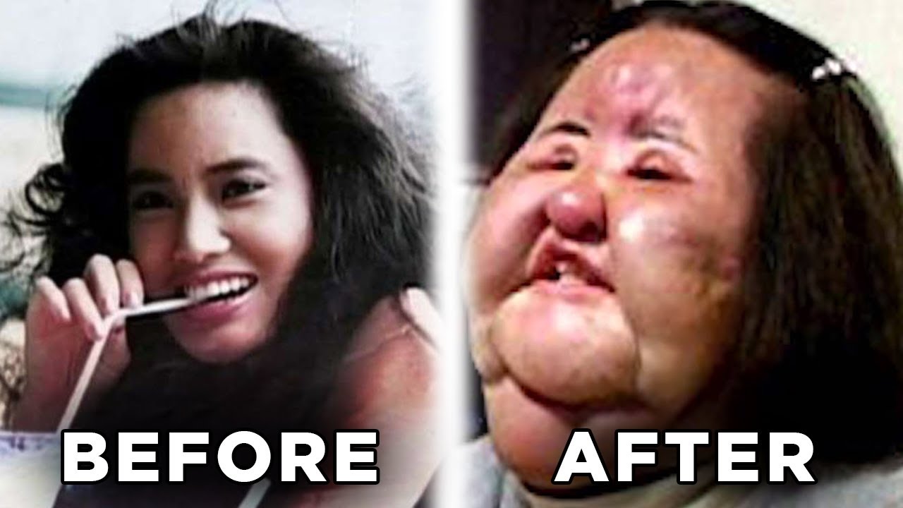 beauty treatments gone wrong