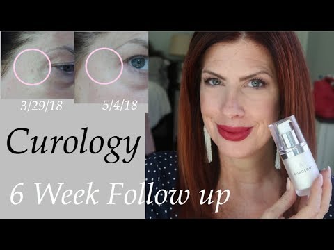 curology 6 week follow up beauty over 50