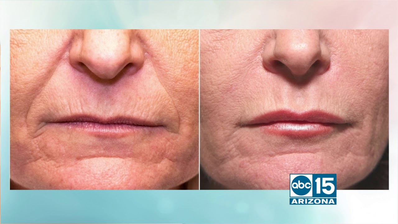 glo medspa offers beauty treatments that last all year