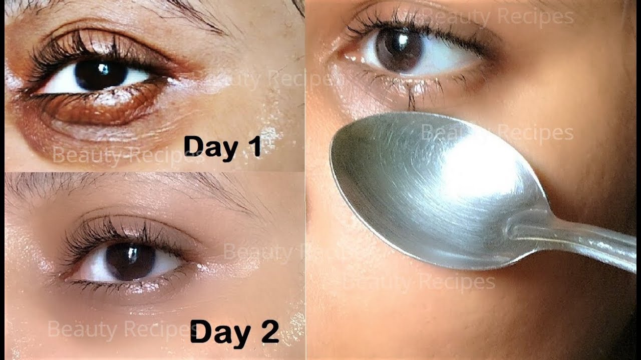 how to remove under eye wrinkles under eye bags puffy eyes dark circles in 1 day with ice cubes