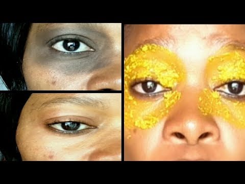 i use turmeric to clear my dark under eye circle in 3 days