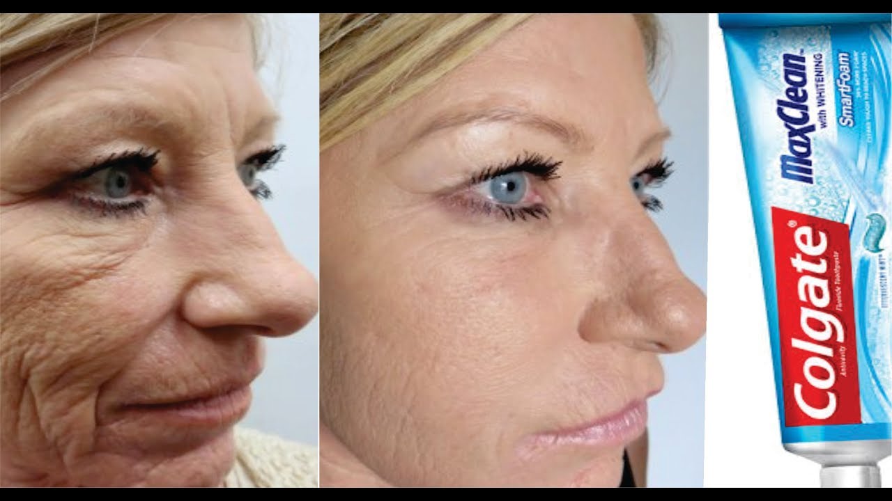if only you knew remove wrinkles forever