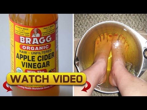 this happens if you dip your feet in vinegar one night a week