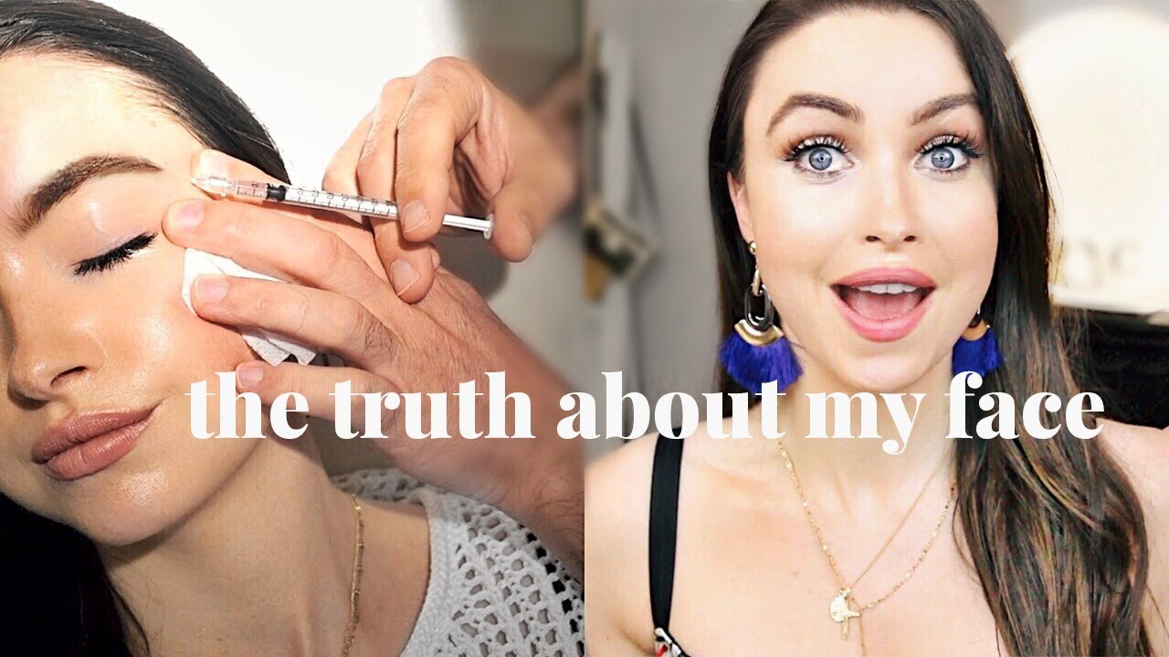 truth about my face fake nose fake lips beauty treatments cosmetic surgery emma miller