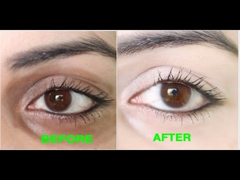 how to remove dark circles naturally in 3 days 100 results